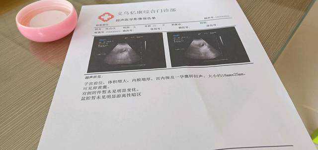 广州供卵在正规医院做吗能报销吗多少钱