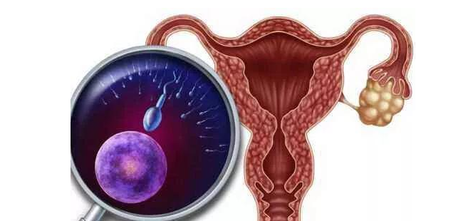 预防子宫内膜癌：四种护理与七种有效治疗方案