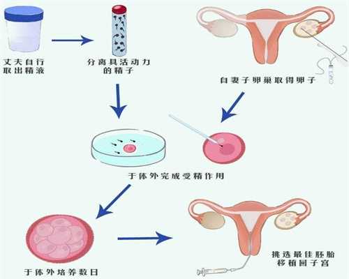 试管代孕哪种成功率高-代孕公司供卵_通过试管婴儿技术助孕的女性，取卵后孕
